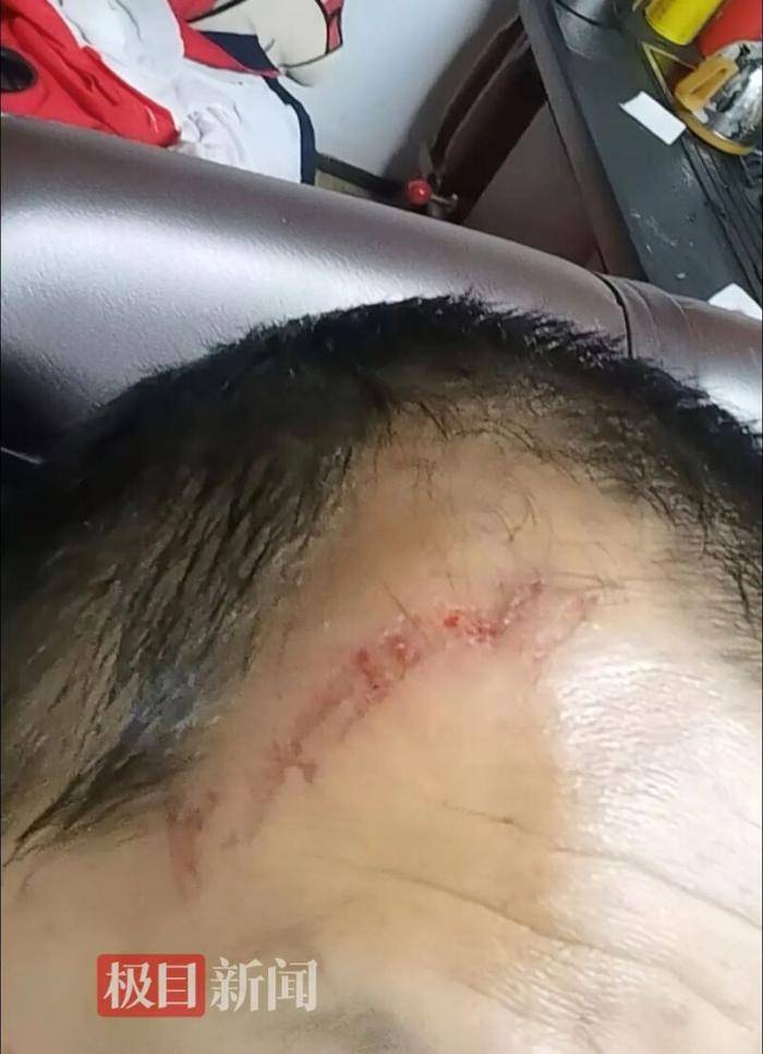 张家口一景区观光魔毯失控，多名游客被甩出，文旅局介入调查