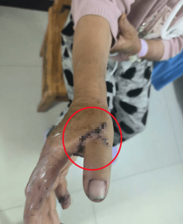 疑打井纠纷，河北邯郸一小学教师杀害33岁邻居，广平县教体局：警方正进一步侦办此案